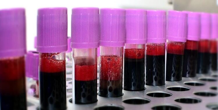 Ne zaboravite darovati krv u ljetnim mjesecima kada su povećane potrebe